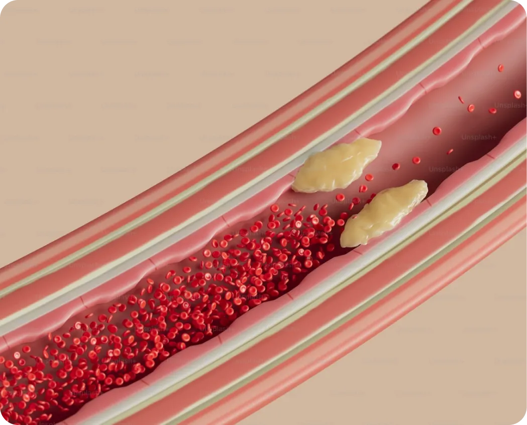 Illustration of blood flowing through an artery