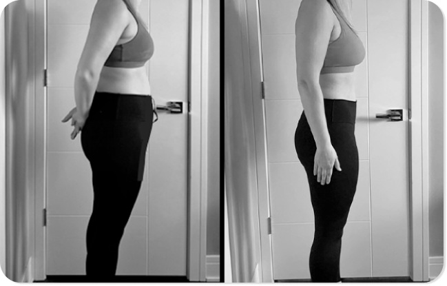Before and after Motus, side profile comparison